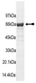 SDS-PAGE (PLK1-201H).jpg